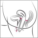 Vaginal Speculum Vaginal Speculum