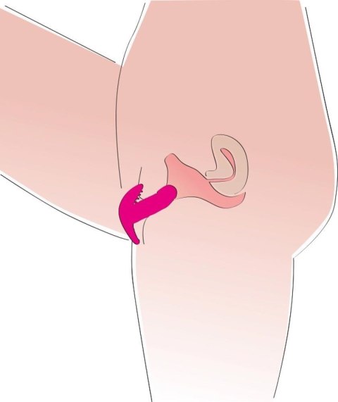 My little secret silicone My little secret silicone